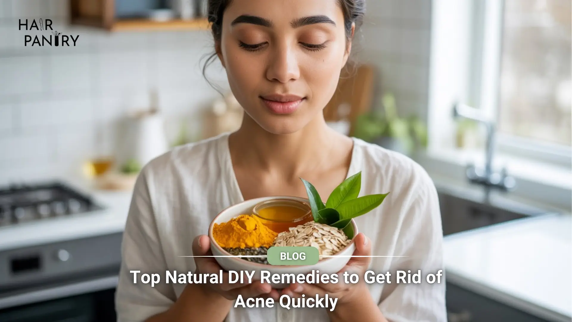 Natural DIY Remedies to Get Rid of Acne Quickly